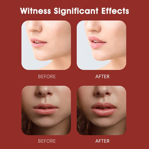 Electric Silicone Lip Plumper for Fuller Lips