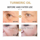 Turmeric Dark Spot Corrector Serum