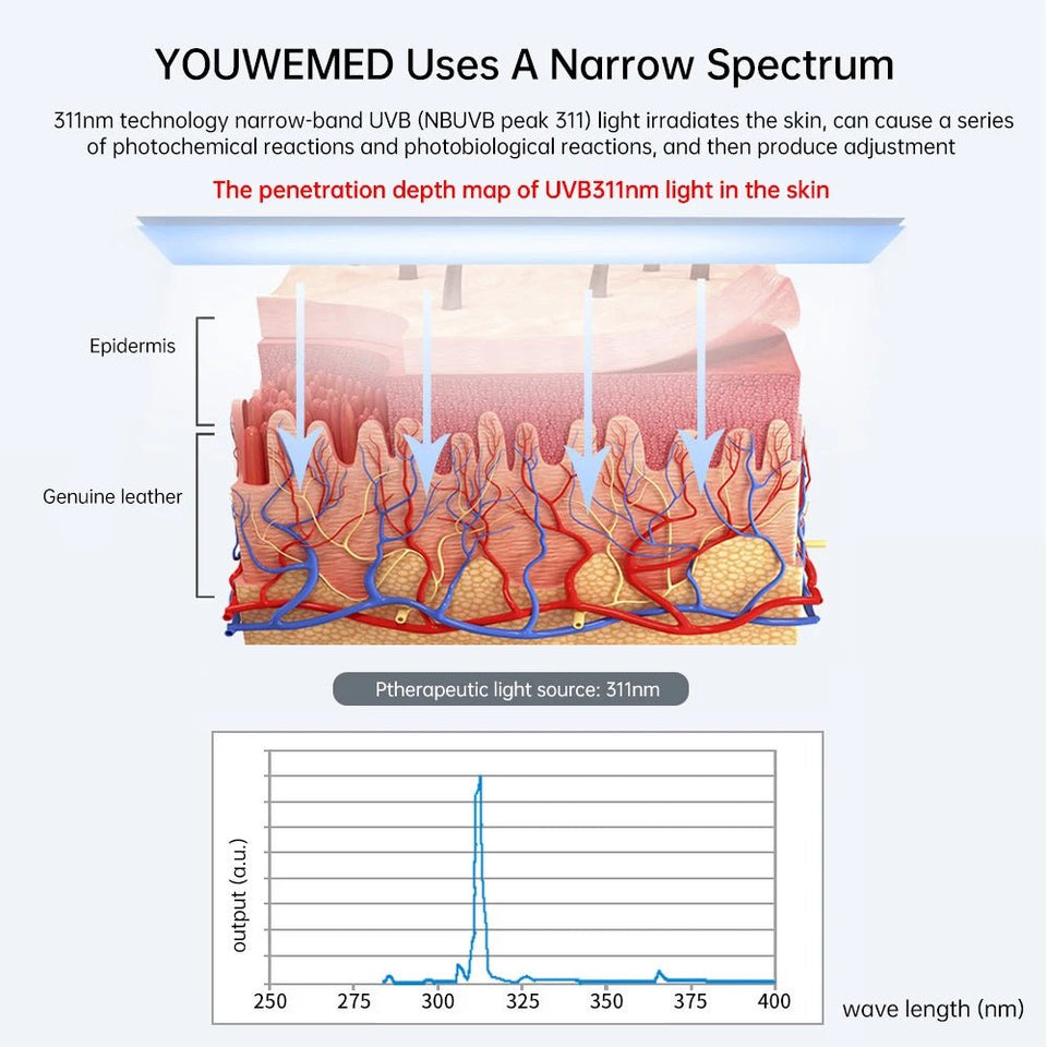 UVB Phototherapy Lamp for Skin Disorders South Africa